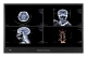 POCi-W24C-RPL-i5/PC